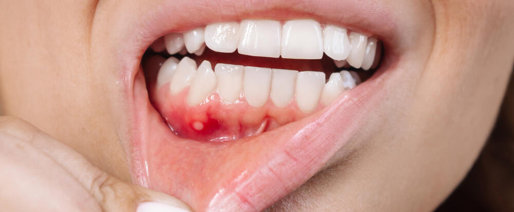Infection and swelling